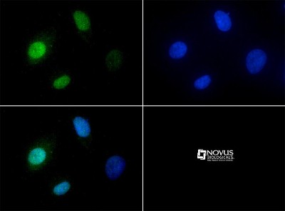 Immunocytochemistry/Immunofluorescence: KDM2A/FBXL11 Antibody [NBP1-78305] - Antibody was tested in HeLa cells with FITC (green). Nuclei were counterstained with DAPI (blue).