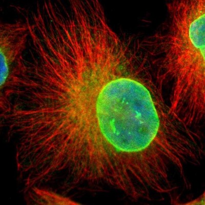 Immunocytochemistry/Immunofluorescence: Emerin Antibody [NBP1-87692] - Immunofluorescent staining of human cell line U-251 MG shows localization to nuclear membrane & endoplasmic reticulum.