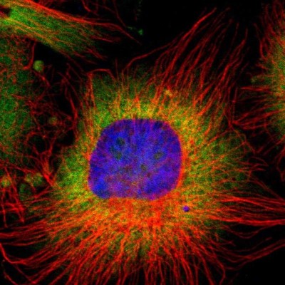 Immunocytochemistry/Immunofluorescence: RPL9 Antibody [NBP1-82853] - Immunofluorescent staining of human cell line U-251 MG shows localization to nucleoli, cytosol & endoplasmic reticulum.
