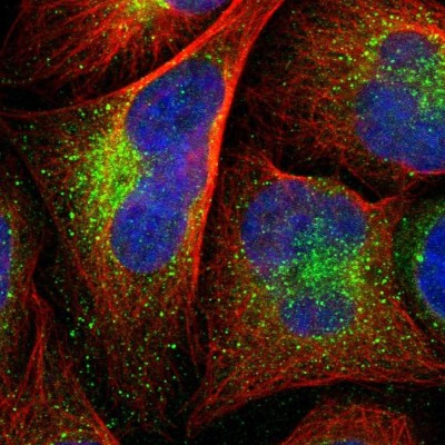 Immunocytochemistry/Immunofluorescence: EFCBP2 Antibody [NBP1-84002] - Immunofluorescent staining of human cell line U-2 OS shows localization to vesicles.
