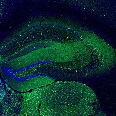 Immunocytochemistry/Immunofluorescence: EFCBP2 Antibody [NBP1-84002] - Staining  mouse hippocampus shows immunoreactivity in a subset of neurons.