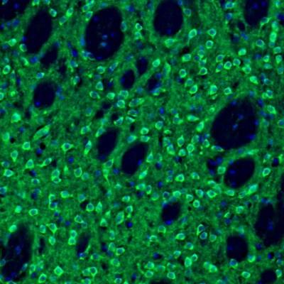 Immunocytochemistry/Immunofluorescence: EFCBP2 Antibody [NBP1-84002] - Staining  mouse caudate putamen shows immunoreactivity in medium spiny neurons and synapses.