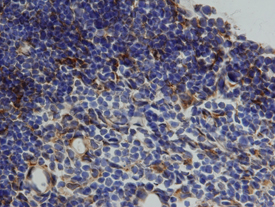 Cathepsin L was detected in perfusion fixed frozen sections of mouse thymus using 15 µg/mL Goat Anti-Mouse Cathepsin L Antigen Affinity-purified Polyclonal Antibody (Catalog # AF1515) overnight at 4 °C. Tissue was stained with the Anti-Goat HRP-DAB Cell & Tissue Staining Kit (brown; Catalog # CTS0028) and counterstained with hematoxylin (blue). View our protocol for Chromogenic IHC Staining of Frozen Tissue Sections.