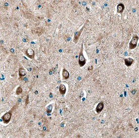 Syntaxin 8 was detected in immersion fixed paraffin-embedded sections of human brain using Sheep Anti-Human/Mouse/Rat Syntaxin 8 Antigen Affinity-purified Polyclonal Antibody (Catalog # AF5448) at 10 µg/mL overnight at 4 °C. Before incubation with the primary antibody, tissue was subjected to heat-induced epitope retrieval using Antigen Retrieval Reagent-Basic (Catalog # CTS013). Tissue was stained using the Anti-Sheep HRP-DAB Cell & Tissue Staining Kit (brown; Catalog # CTS019) and counterstained with hematoxylin (blue). Specific staining was localized to neuronal cell bodies and processes. View our protocol for Chromogenic IHC Staining of Paraffin-embedded Tissue Sections.