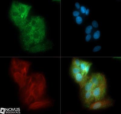 Immunocytochemistry/Immunofluorescence: Glut2 Antibody [NBP2-22218] - Glut2 antibody was tested in HepG2 cells with DyLight 488 (green). Nuclei and alpha-tubulin were counterstained with DAPI (blue) and Dylight 550 (red).