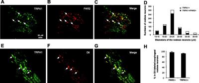 Immunocytochemistry/Immunofluorescence: TRPA1 Antibody [NB100-98841] - IF on vagal nodose ganglia. Image from verified customer review.