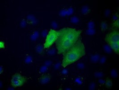 Immunocytochemistry/Immunofluorescence: ACAT2 Antibody (3E2) [NBP2-02588] - Staining of COS7 cells transiently transfected by pCMV6-ENTRY ACAT2.