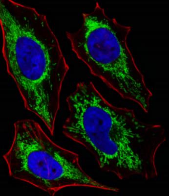 Immunocytochemistry/Immunofluorescence: Glutaminase Antibody [NBP2-29940] - Fluorescent image of Hela cells stained with XAF1  (C-term)(Cat# NBP2-29940). The antibody was diluted at 1:25 dilution. An Alexa Fluor 488-conjugated goat anti-rabbit lgG at 1:400 dilution was used as the secondary antibody (green). DAPI was used to stain the cell nuclear (blue). Cytoplasmic actin was counterstained with Alexa Fluor 555 conjugated with Phalloidin (red).