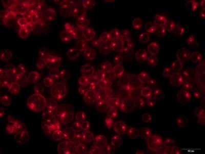 Immunofluorescence: MICA Antibody [NBP1-76805] - analysis of MICA in Jukat cells using anti-MICA antibody. Image from verified customer review.