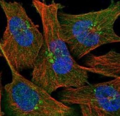 Immunocytochemistry/Immunofluorescence: NAPRT1 Antibody [NBP1-87243] - Staining  of human cell line U-251MG shows positivity in nucleus but not nucleoli, cytoplasm and golgi apparatus.
