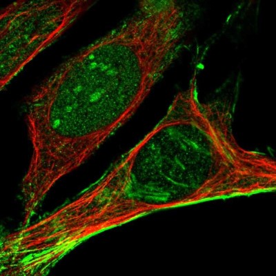 Immunocytochemistry/Immunofluorescence: Septin-2 Antibody [NBP1-85212] - Immunofluorescent staining of human cell line U-2 OS shows localization to nucleus, nucleoli & actin filaments.