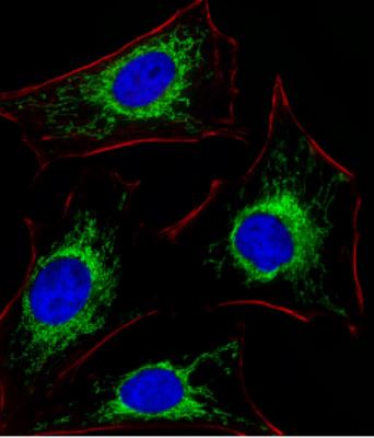Immunocytochemistry/Immunofluorescence: Glutaminase Antibody [NBP2-29940] - Fluorescent image of Hela cells stained with XAF1  (C-term)(Cat# NBP2-29940). The antibody was diluted at 1:25 dilution. An Alexa Fluor 488-conjugated goat anti-rabbit lgG at 1:400 dilution was used as the secondary antibody (green). DAPI was used to stain the cell nuclear (blue). Cytoplasmic actin was counterstained with Alexa Fluor 555 conjugated with Phalloidin (red).