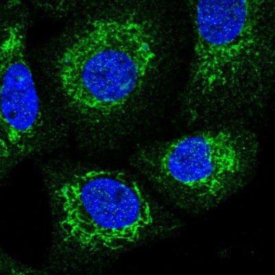 Immunocytochemistry/Immunofluorescence: SQRDL Antibody [NBP1-84510] - Immunofluorescent staining of human cell line A549 shows localization to mitochondria.