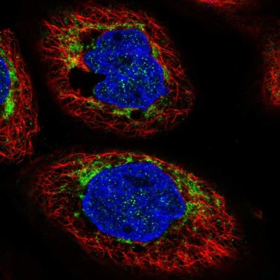 Immunocytochemistry/Immunofluorescence: CHCHD6 Antibody [NBP1-91779] - Immunofluorescent staining of human cell line A-431 shows localization to mitochondria.