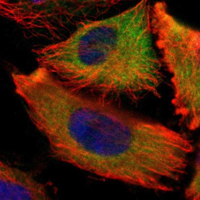Immunocytochemistry/Immunofluorescence: IGF2BP3 Antibody [NBP1-84339] - Immunofluorescent staining of human cell line U-251 MG shows localization to cytosol.