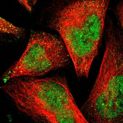 Immunocytochemistry/Immunofluorescence: PSMD14 Antibody [NBP1-80956] - Immunofluorescent staining of human cell line U-2 OS shows localization to nucleoplasm & vesicles.