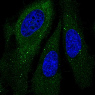 Immunocytochemistry/Immunofluorescence: GSPT1 Antibody [NBP2-47442] - Immunofluorescent staining of human cell line HeLa shows localization to cytosol & vesicles.