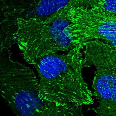 Immunocytochemistry/Immunofluorescence: Mena Antibody [NBP1-87914] - Immunofluorescent staining of human cell line U-2 OS shows localization to plasma membrane, cytosol & focal adhesion sites.