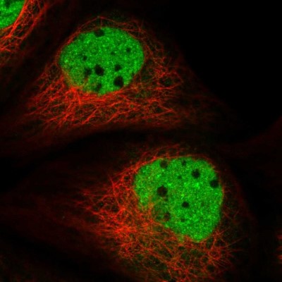 Immunocytochemistry/Immunofluorescence: ADPRHL2 Antibody [NBP1-88835] - Immunofluorescent staining of human cell line A-431 shows localization to nucleoplasm.