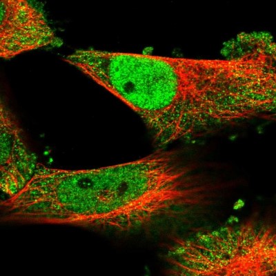 Immunocytochemistry/Immunofluorescence: ECSIT Antibody [NBP1-91858] - Immunofluorescent staining of human cell line U-251 MG shows localization to nucleoplasm & cytosol.
