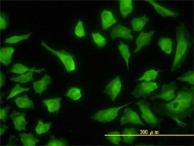 Immunocytochemistry/Immunofluorescence: Argininosuccinate Lyase Antibody (4C5-1F2) [H00000435-M01] - Analysis of monoclonal antibody to ASL on HeLa cell. Antibody concentration 5 ug/ml.