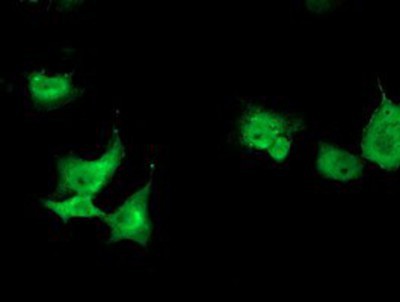 Immunocytochemistry/Immunofluorescence: TOMM34 Antibody (2A9) [NBP2-00892] - Staining of COS7 cells transiently transfected by pCMV6-ENTRY TOMM34.