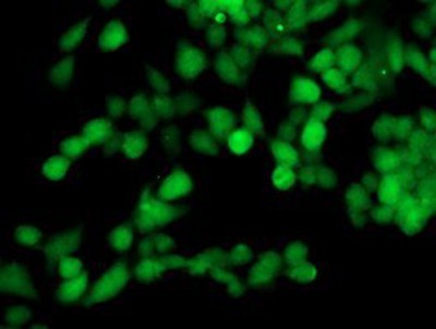 Immunocytochemistry/Immunofluorescence: TOMM34 Antibody (2A9) [NBP2-00892] - Immunofluorescent staining of HeLa cells using anti-TOMM34 mouse monoclonal antibody.
