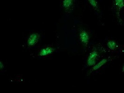 Immunocytochemistry/Immunofluorescence: GSPT2 Antibody (2G9) [NBP2-00873] - Immunofluorescent staining of HeLa cells using anti-GSPT2 mouse monoclonal antibody.