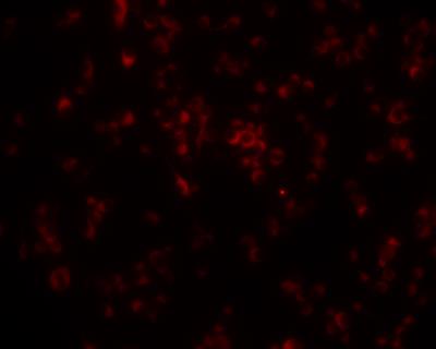 Immunocytochemistry/Immunofluorescence: LPCAT2 Antibody [NBP1-88921] - Staining of murine cell line RAW264.7. Image provided by product review by verified customer.