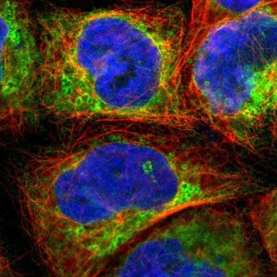 Immunocytochemistry/Immunofluorescence: LPCAT2 Antibody [NBP1-88921] - Staining of human cell line A-431 shows positivity in endoplasmic reticulum.