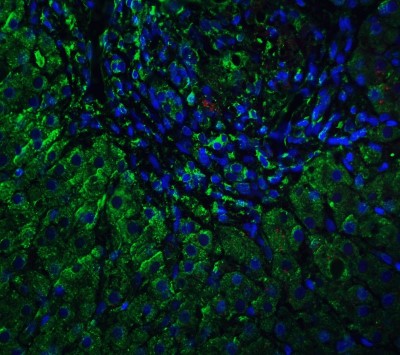 Immunocytochemistry/Immunofluorescence: VPS39 Antibody [NBP1-76535] - Staining of VPS39 in human liver tissue with VPS39 antibody at 5 ug/ml.