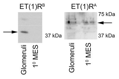 Western Blot: EDNRA/Endothelin R Type A Antibody [NB600-836] - ET-1 A & B Receptor Western provided by verified customer review.