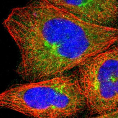 Immunocytochemistry/Immunofluorescence: Njmu-R1 Antibody [NBP1-82563] - Immunofluorescent staining of human cell line A-431 shows localization to cytosol & the Golgi apparatus.