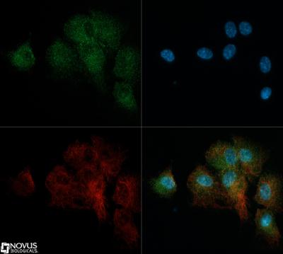 Immunocytochemistry/Immunofluorescence: Robo4 Antibody [NB110-58778] - Robo4 antibody was tested in Huvec cells with Dylight 488 (green). Nuclei and alpha-tubulin were counterstained with DAPI (blue) and Dylight 550 (red).