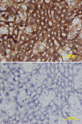 Clusterin was detected in perfusion fixed frozen sections of mouse liver using Goat Anti-Mouse Clusterin Antigen Affinity-purified Polyclonal Antibody (Catalog # AF2747) at 15 µg/mL overnight at 4 °C. Tissue was stained using the Anti-Goat HRP-DAB Cell & Tissue Staining Kit (brown; Catalog # CTS008) and counterstained with hematoxylin (blue). Lower panel shows a lack of labeling if primary antibodies are omitted and tissue is stained only with secondary antibody followed by incubation with detection reagents. View our protocol for Chromogenic IHC Staining of Frozen Tissue Sections.
