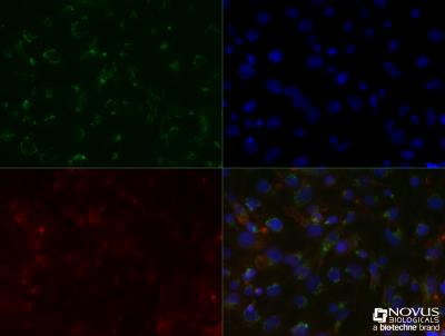 Immunocytochemistry/Immunofluorescence: SLC31A1/CTR1 Antibody (5E6.1B4) [NBP2-36573] - HepG2 cells were fixed for 10 minutes using 10% formalin and then permeabilized for 5 minutes using 1X TBS + 0.5% Triton-X100.  The cells were incubated with anti SLC31A1/CTR1 (5E6.1B4) NBP2-36573 at a 1:50 dilution overnight at 4C and detected with an anti-mouse Dylight 488 (Green) at a 1:500 dilution.  Actin was detected with Phalloidin 568 (Red) at a 1:200 dilution.  Nuclei were counterstained with DAPI (Blue).  Cells were imaged using a 40X objective.