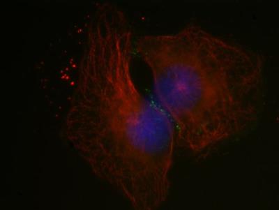 Immunocytochemistry/Immunofluorescence: PARD3/Par3 Antibody [NBP1-88861] - Staining of human cell line 8505C cells (anaplastic thyroid cancer cell line). Image from verified customer review.