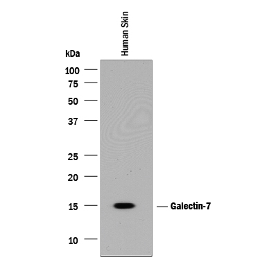 Western  blot shows lysates of human skin tissue. PVDF membrane was probed with  1 µg/mL of Goat Anti-Human Galectin‑7 Antigen  Affinity-purified Polyclonal Antibody (Catalog # AF1339) followed by  HRP-conjugated Anti-Goat IgG Secondary Antibody (Catalog # HAF017).  A specific band was detected for Galectin‑7 at approximately  15 kDa (as indicated). This experiment was conducted under reducing  conditions and using Immunoblot  Buffer Group 1.