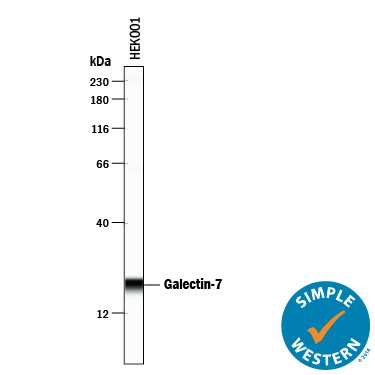 Simple Western lane view shows lysates of HEK001 human epidermal keratinocyte cell line, loaded at 0.2 mg/mL. A specific band was detected for Galectin‑7 at approximately 21 kDa (as indicated) using 10 µg/mL of Goat Anti-Human Galectin‑7 Antigen Affinity-purified Polyclonal Antibody (Catalog # AF1339) followed by 1:50 dilution of HRP-conjugated Anti-Goat IgG Secondary Antibody (Catalog # HAF109). This experiment was conducted under reducing conditions and using the 12-230 kDa separation system.