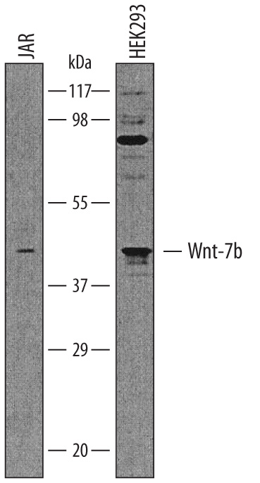 Western blot shows lysates of JAR human choriocarcinoma cell line and HEK293 human embryonic kidney cell line. PVDF membrane was probed with 1 µg/mL of Goat Anti-Human Wnt‑7b Antigen Affinity-purified Polyclonal Antibody (Catalog # AF3460) followed by HRP-conjugated Anti-Goat IgG Secondary Antibody (Catalog # HAF019). A specific band was detected for Wnt‑7b at approximately 45 kDa (as indicated). This experiment was conducted under reducing conditions and using Immunoblot Buffer Group 1.