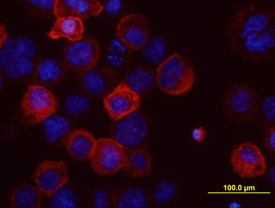 ABCG2 was detected in immersion fixed Human ABCG2 transfected CHO Chinese hamster ovary cell line using Mouse Anti-Human ABCG2 Monoclonal Antibody (Catalog # MAB995) at 10 µg/mL for 3 hours at room temperature. Cells were stained using the NorthernLights™ 557-conjugated Anti-Mouse IgG Secondary Antibody (red; Catalog # NL007) and counterstained with DAPI (blue). View our protocol for Fluorescent ICC Staining of Cells on Coverslips.