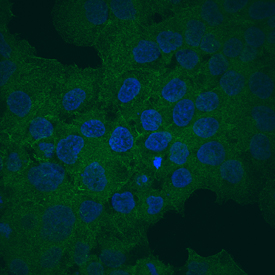 ATP-Binding Cassette Transporter G2 (ABCG2) was detected in immersion fixed JAR human choriocarcinoma cell line using Mouse Anti-Human ABCG2 Monoclonal Antibody (Catalog # MAB995) at 10 µg/mL for 3 hours at room temperature. Cells were stained using the NorthernLights™ 493-conjugated Anti-Mouse IgG Secondary Antibody (green; Catalog # NL009) and counterstained with DAPI (blue). View our protocol for Fluorescent ICC Staining of Cells on Coverslips.