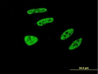 Immunocytochemistry/Immunofluorescence: TRIM32 Antibody (2E5) [H00022954-M09] - Analysis of monoclonal antibody to TRIM32 on HeLa cell. Antibody concentration 10 ug/ml