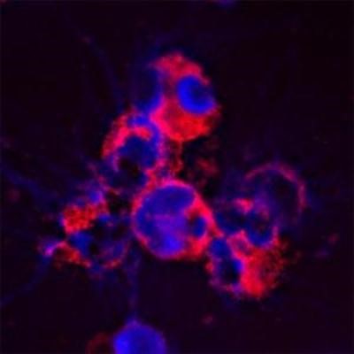 Immunocytochemistry/Immunofluorescence: CACNA1I Antibody [NBP1-30674] - Staining of a cytospin preparation of peripheral blood mononuclear cells (PBMC) isolated from buffycoat. Cells were left to air dry and then fixed with cold acetone (90 seconds) and blocked with PBS containing 1% FCS and 0.1% saponin (blocking buffer) for 20 minutes. Cells were then washed twice in PBS and incubated with Mouse monoclonal to human Cathelicidin (CAP-18, antibacterial protein LL-37, CAMP, CRAMP, FALL39): OSX12 clone at a concentration of 10 ug/ml. DAPI counterstained appearing in blue. The antibody selectively recognizes polymorphonuclar cells.