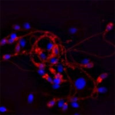 Immunocytochemistry/Immunofluorescence: CACNA1I Antibody [NBP1-30674] - IF on ethanol-fixed human spermatosoid using Mouse monoclonal to human Cathelicidin (CAP-18, antibacterial protein LL-37, CAMP, CRAMP, FALL39): OSX12 clone at a concentration of 10 ug/ml. DAPI counterstained appearing in blue.