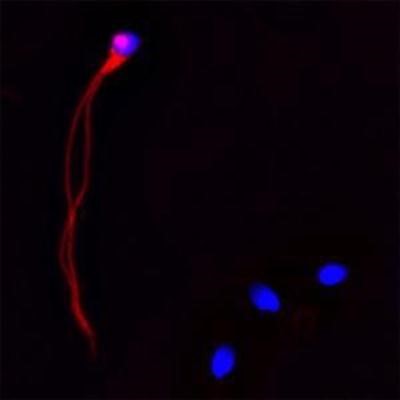 Immunocytochemistry/Immunofluorescence: CACNA1I Antibody [NBP1-30674] - IF on ethanol-fixed human spermatosoid using Mouse monoclonal to human Cathelicidin (CAP-18, antibacterial protein LL-37, CAMP, CRAMP, FALL39): OSX12 clone at a concentration of 10 ug/ml. DAPI counterstained appearing in blue.