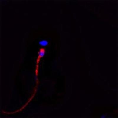 Immunocytochemistry/Immunofluorescence: CACNA1I Antibody [NBP1-30674] - IF on ethanol-fixed human spermatosoid using Mouse monoclonal to human Cathelicidin (CAP-18, antibacterial protein LL-37, CAMP, CRAMP, FALL39): OSX12 clone at a concentration of 10 ug/ml. DAPI counterstained appearing in blue.