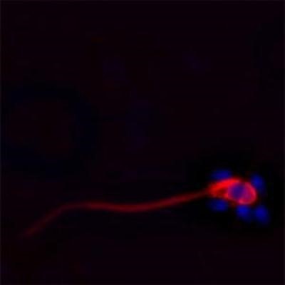 Immunocytochemistry/Immunofluorescence: CACNA1I Antibody [NBP1-30674] - IF on ethanol-fixed human spermatosoid using Mouse monoclonal to human Cathelicidin (CAP-18, antibacterial protein LL-37, CAMP, CRAMP, FALL39): OSX12 clone at a concentration of 10 ug/ml. DAPI counterstained appearing in blue.
