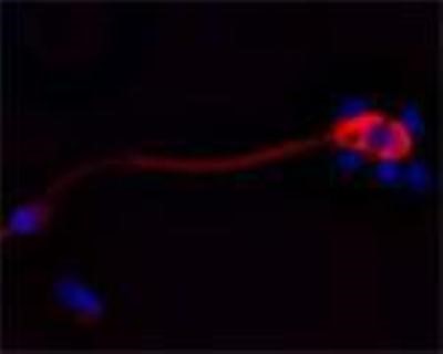 Immunocytochemistry/Immunofluorescence: CACNA1I Antibody [NBP1-30674] - IF on ethanol-fixed human spermatosoid using Mouse monoclonal to human Cathelicidin (CAP-18, antibacterial protein LL-37, CAMP, CRAMP, FALL39): OSX12 clone at a concentration of 10 ug/ml. DAPI counterstained appearing in blue.