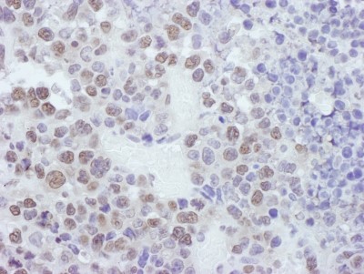 Immunohistochemistry: cleavage stimulation factor Antibody [NB100-60443] - Sample: FFPE section of mouse plasmacytoma. Antibody: Affinity purified rabbit anti-CSTF50 used at a dilution of 1:1,000 (1ug/ml). Detection: DAB